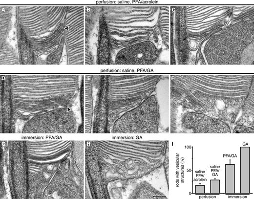 Figure 5. Perturbations of rod outer segment structure caused by variations in tissue preparation procedure. (A–C) Representative EM images of rod outer segment bases fixed according to Chuang et al. (2007) and treated with tannic acid–uranyl acetate. (D–F) Representative EM images of rod outer segment bases obtained after introducing an additional heparin saline perfusion step before paraformaldehyde/glutaraldehyde (PFA/GA) fixation. (G and H) Representative EM image of a rod outer segment base obtained from eyecups immersed in PFA/GA (G) or GA (H) fixative. (I) Quantification of the fraction of rods containing vesicular structures at the outer segment base. The number of cells analyzed for each condition was 138 (saline PFA/acrolein), 343 (saline PFA/GA), 57 (PFA/GA), and 31 (GA). The data are averaged from cell counts in three mice treated under each condition; error bars represent SEM. Arrowheads point to the membrane fusion points. Bar, 200 nm. See also Fig. S1.