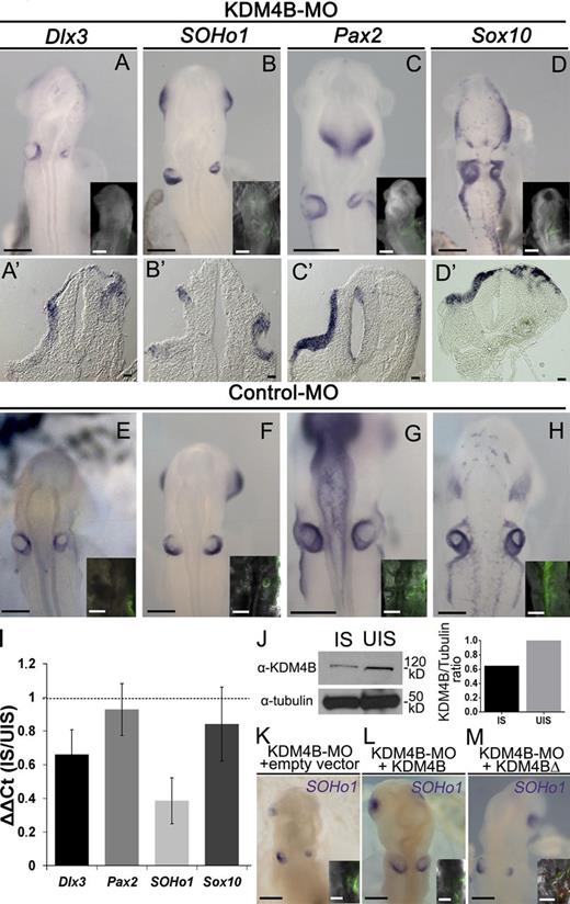 Figure 3. KDM4B loss of function results in ear deformities and reduction in marker gene expression. (A–H) Electroporation of KDM4B-MO into the right side of the embryo (green staining in inset) causes a dramatic reduction in the otic placode domain as indicated by the expression of the otic placode markers Soho1, Pax2, Sox10, and Dlx3 in embryos examined at stages 12/13 (A–D), compared with the left uninjected side and control-MO–treated embryos (E–H). Transverse sections (A’–D’) reveal disorganization of the otic tissue. (I) RT-qPCR analyses show a consistent reduction in Dlx3 and SOHo1 expression, but moderate for Sox10 and Pax2, on the KDM4B-MO–injected side (IS) compared with the uninjected side (UIS). Vertical bars represent the ΔΔCt ratio between the injected and uninjected side from the same pool of embryos. Vertical error bars on data points represent the standard error of mean obtained from three independent samples, including eight otic vesicles on each. Horizontal dotted line indicates the threshold ΔΔCt ratio (injected side/uninjected side = 1). (J) Western blot analysis, performed from 16 isolated otic vesicles, reveals a 36% reduction of KDM4B protein expression on the KDM4B-MO–injected side compared with the uninjected side. (K–M) Electroporation of KDM4B-MO (green fluorescence in inset), together with a vector containing the coding region of KDM4B, rescues the depletion of SOHo1 as assayed by ISH and the otic placode invagination (L). In contrast, coelectroporation of KDM4B-MO plus an empty vector (K) or catalytically dead mutant of Kdm4b (KDM4BΔ; M) failed to rescue the loss-of-function phenotype (see Fig. S2 for phenotypes quantitation). Bars: (A–H and K–M) 200 µm; (A’–D’) 20 µm.