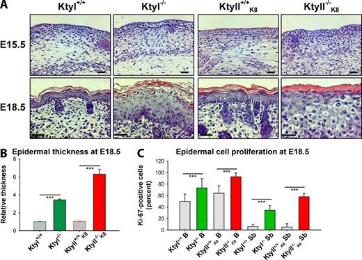 Figure 2. KtyI and KtyII ablation causes epidermal thickening, hyperproliferation, cytolysis, and distinct structural abnormalities of the granular and stratum layers. (A) Hematoxylin/eosin-stained skin sections of E15.5 and E18.5 mouse embryos. Note apparently normal epidermis at E15.5 but hyperthickening and cytolysis (asterisk) in KtyI−/− and KtyII−/−K8 at E18.5. Large keratohyalin granules in KtyI−/− and their absence in KtyII−/−K8 epidermis, which shows a compact stratum corneum. Bars, 20 µm. (See also different magnification of other pictures in Fig. S3 A). (B) Measurements showing distinct increase of epidermal thickness at E18.5 in KtyI−/− and KtyII−/−K8. (C) Ki-67–based quantification of proliferation rates in basal (B) and suprabasal (Sb) cells of the epidermis of WT and KtyI−/− and KtyII−/−K8 embryos at E18.5 (see pictures in Fig. S3 C), showing significant increase in the absence of KIF. ***, P ≤ 0.001.
