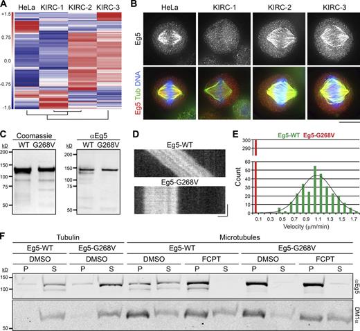Figure 1. KIRC-2 and -3 express a spontaneous Eg5 rigor mutant, Eg5-G268V. (A) Each KIRC line is clonally distinct. Unsupervised cluster and heatmap analysis of indicated cell types. The dendrogram (bottom) shows that KIRC-1 and KIRC-2 are most similar based on gene expression. HeLa is more similar to KIRC-1 and KIRC-2 than KIRC-3. KIRC-3 is the most distinct cell line. (B) Eg5 binds spindle MTs in KIRC-2 and -3 cells despite the presence of STLC. Single optical sections of indicated cell types stained with antibodies targeting Eg5 (grayscale and red) and tubulin (green). DNA, blue. Lookup tables (LUTs) for grayscale and red channel are scaled identically. Bar, 10 µm. See also Fig. S1. (C) Purification of recombinant Eg5 proteins. (left) Protein gel of Eg5-WT and Eg5-G268V preparations stained with Coomassie-blue. (right) Western blot of Eg5-WT and Eg5-G268V preparations probed with antibodies targeting Eg5 (αEg5). (D) Eg5-G268V is immotile. Kymographs of single XR-MTs in gliding assays propelled by Eg5-WT or Eg5-G268V. Bars: (x axis) 1 µm; (y axis) 1 min. See also Videos 1 and 2. (E) Histogram showing gliding velocities from D. Values represent the number of MTs observed to move at indicated velocities in gliding assays powered by Eg5-WT (green) or Eg5-G268V (red). Velocities are reported in micrometers per minute and binned every 0.1 µm/min. n = 300 from three independent experiments. Distributions of Eg5-WT velocities are fit to a single Gaussian (R2 = 0.91). (F) Eg5-G268V does not release from MTs in the presence of ATP. Blot of pellet (P) and supernatant (S) fractions from reactions containing Eg5-WT or Eg5-G268V with tubulin or microtubules in the presence of DMSO or FCPT as indicated, probed with antibodies targeting Eg5 (αEg5) and tubulin (DM1α).