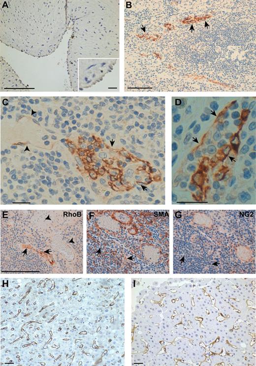Figure 2. RhoB is expressed in intestinal vessels of patients with Crohn’s disease and hepatic sinusoids. (A) Moderate immunohistochemical staining of RhoB from human umbilical veins. (B–D) Large intestine from a patient with Crohn’s disease showing intense endothelial RhoB staining (arrows) in inflamed vessels containing high levels of adhered immune cells. (C and D) Differential RhoB staining, which suggests increased RhoB expression in vessel areas with high levels of leukocyte adhesion and capillary hyperplasia (arrows), with respect to areas with no immune cells (arrowheads; see Fig. S2). (E–G) Consecutive tissue sections showing that RhoB is preferentially expressed in small vessels positive for smooth muscle actin (SMA) and negative for the NG2 proteoglycan. (H and I) RhoB staining in sinusoids from a control liver (H) and hepatitis B virus–infected liver (I). Bars: (A, B, and E–I) 100 µm; (A, inset, and C and D) 10 µm.