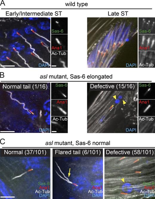 Figure 9. Asl is required for proper function of sperm basal bodies. (A–C) Sas-6 (green) on BBs (Ana1::tdTomato, red) in early/intermediate (left) or late (right) STs. Axonemes, Ac-tub (gray); DNA, DAPI (blue). (A) wt (asl/TM6) STs. In early/intermediate STs (left), basal bodies are docked at the nucleus and form axonemes. The nuclei of late STs are elongated and clustered. (B) Remnant centrioles in asl mutant STs with “elongated” region of Sas-6 (n = 16). ST at all stages were examined. Bracket, distal extension of Ana1 beyond Sas-6. (left) The only remnant centriole (early/intermediate ST) with elongated Sas-6 exhibiting normal nuclear attachment and axoneme nucleation. (right) Representative remnant ST centriole not attached to a nucleus or forming an axoneme. The nuclei of late stage asl STs are fragmented and dispersed (yellow arrowheads). (C) Remnant centrioles in asl mutants with a “normal” distribution of Sas-6 (restricted to the very proximal end; n = 101). (left) Representative remnant centriole in an early/intermediate ST exhibiting normal nuclear attachment and axoneme formation. (middle) Representative remnant centriole in an early/intermediate ST with a disrupted, flared axoneme (arrow). (right) Representative remnant centrioles in late STs not attached to nuclei or nucleating axonemes. Yellow arrowhead indicates nucleus that has not undergone reshaping. Additional examples are shown in Fig. S5. Bars: 5 µm; (insets) 1 µm. Defective, no axoneme or no nuclear attachment or both.