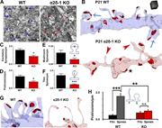 Figure 3. Ultrastructural analysis reveals that α2δ-1 promotes synapse and spine maturation. (A) Electron micrographs from P21 V1 WT and α2δ-1 KO brains. Arrows, excitatory synapses. Bar, 1 µm. (B) ssEM 3D reconstructions of LI dendrites from P21 WT and α2δ-1 KO V1. Red, excitatory postsynaptic densities; blue arrows, mushroom spines; red arrowheads, nonsynaptic filopodia; black star, bulged region of dendritic shaft. Cube, 0.5 µm3. (C–F) Densities calculated from reconstructions of excitatory synapses (C), protrusions (D), mushroom spines (E), and thin spines (F). E and F show the width (W) and length (L) measurements used in spine identification (n = 4 dendrites/animal; three animals per genotype). Two-tailed t test. Error bars represent SEM. (G) Spines in the WT and filopodia in the α2δ-1 KO. (H) Comparison of filopodia (F) and spine (S) densities between the WT and α2δ-1 KO (n = 4 dendrites/animal; three animals per genotype). One-way ANOVA with Tukey’s multiple comparisons post hoc test. *, P < 0.05; **, P < 0.001; ***, P < 0.0001.
