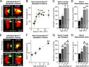 Figure 4. Synaptic Nrxn1 nanoclusters are dynamic across development. (A) Example synapses illustrating the features of Nrxn1 nanoclusters in cultured neurons at DIV18 (top) and DIV26 (bottom), including central and peripheral localizations of Nrxn1 nanoclusters (scale bars, 0.2 µm). (B) The percentage of Homer1(+) synapses with Nrxn1 nanoclusters in cultured neurons as a function of culture time. (C and D) The relative Nrxn1 content (C) and size of synaptic Nrxn1 nanoclusters (D) increase during development in hippocampal neurons analyzed at the indicated culture DIVs (shown as percentage of DIV4 levels). (E) Same as A, except of Nrxn1 nanoclusters in hippocampal CA1 region from HA-Nrxn1 cKI mice at P14 (top) and P28 (bottom; scale bars, 0.2 µm). (F) Same as B, except that cryostat sections of the hippocampal CA1 region from HA-Nrxn1 cKI mice were analyzed as a function of age. (G and H) Same as C and D, but for cryostat sections of the hippocampal CA1 region of HA-Nrxn1 cKI mice analyzed at P1–28 (values are expressed as percentage of P1). Numerical data are means ± SEM. Statistical significance was determined by two-sample t test to earliest time point (*, P < 0.05; **, P < 0.01; ***, P < 0.001). For B and F, n = 3 cultures or mice, averaged per culture or mouse; for C and D, n as number of synapses = 6, DIV4; 12, DIV10; 78, DIV18; 85, DIV26/three cultures; for G and H, n as number of synapses = 45, P1; 41, P7; 22, P14; 77, P28/three mice. For further details, see Fig. S1.