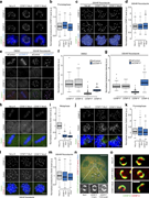 CENP-F controls corona localization in a microtubule-dependent manner. (a) Immunofluorescence microscopy images of early prometaphase HeLa-K, CNP-F-Mut1, and CENP-F-Mut2 cells stained with DAPI and antibodies against CENP-C and CENP-E. Scale bar, 5 µm. (b) Quantification of kinetochore CENP-E intensity relative to CENP-C in early prometaphase HeLa-K, CENP-F-Mut1, and CENP-F-Mut2 cells. (c) Immunofluorescence microscopy images of HeLa-K, CENP-F-Mut1, and CENP-Mut2 treated with 330 nM nocodazole for 16 h and stained with DAPI and antibodies against CENP-C and CENP-E. Scale bar, 5 µm. (d) Quantification of kinetochore CENP-E intensities relative to CENP-C in HeLa-K, CENP-F-Mut1, and CENP-Mut2 treated with 330 nM nocodazole for 16 h. (e) Immunofluorescence microscopy images of HeLa-K cells treated with control or CENP-F siRNA, incubated with DMSO or 330 nM nocodazole for 16 h and stained with DAPI, CREST antisera and antibodies against CENP-E and CENP-F. Scale bar, 5 µm. The CREST display intensities are not comparable between DMSO and nocodazole conditions. (f) Quantification of kinetochore CENP-E and CENP-F levels relative to CREST in HeLa-K cells treated with control or CENP-F siRNA and incubated with DMSO for 16 h. (g) Quantification of kinetochore CENP-E and CENP-F levels relative to CREST in HeLa-K cells treated with control or CENP-F siRNA and incubated with 330 nM nocodazole for 16 h. (h) Immunofluorescence microscopy images of metaphase HeLa-K, CENP-F-Mut1, and CENP-F-Mut2 cells stained with antibodies against CENP-C and Zwlich. Scale bar, 5 µm. (i) Quantification of kinetochore Zwlich level relative to CENP-C at kinetochores in metaphase HeLa-K, CENP-F-Mut1, and CENP-F-Mut2 cells. (j) Immunofluorescence microscopy images of early prometaphase HeLa-K, CENP-F-Mut1, and CENP-F-Mut2 cells stained with antibodies against CENP-C and Zwlich. Scale bar, 5 µm. (k) Quantification of kinetochore Zwlich intensities relative to CENP-C in prometaphase HeLa-K, CENP-F-Mut1, and CENP-F-Mut2 cells. (l) Immunofluorescence microscopy images of HeLa-K, CENP-F-Mut1, and CENP-Mut2 cells treated with 330 nM nocodazole for 16 h and stained with antibodies against CENP-C and Zwlich. Scale bar, 5 µm. (m) Quantification of kinetochore Zwlich intensities relative to CENP-C in HeLa-K, CENP-F-Mut1, and CENP-Mut2 cells treated with 330 nM nocodazole for 16 h. (n) Immunofluorescence microscopy images of HeLa-K cells transfected with CENP-F^mEmerald, arrested in 330 nM nocodazole for 16 h, and stained with antibodies against Bub1 and CENP-F C-terminus (Ab5). Insets show a zoom of an expanded kinetochore. Scale bars, 5 µm (upper); 1 µm (lower). (o) Immunofluorescence microscopy images of CENP-E crescents in HeLa-K, CENP-F-Mut1, and CENP-F-Mut2 cells arrested in 330 nM nocodazole for 16 h. Scale bar, 1µm. In b, d, f, g, i, k, and m, boxes depict the median and first and third quartiles, and whiskers represent Q1 and Q3 ± 1.5× interquartile range.