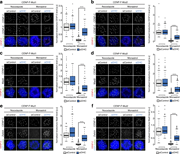 CENP-F functions to limit dynein stripping of the corona. (a) Left: Immunofluorescence microscopy images from the dynein-stripping assay for CENP-E in CENP-F-Mut1 cells. Cells were treated with control or DHC siRNA, arrested in nocodazole or monastrol, and stained with DAPI and antibodies against CENP-E and CENP-C. Scale bar, 5 µm. Right: Quantification of the kinetochore CENP-E intensity relative to CENP-C in the dynein-stripping assay. (b) Left: Immunofluorescence microscopy images of the dynein-stripping assay for CENP-E in CENP-F-Mut2 cells. Cells were treated with control or DHC siRNA, arrested in nocodazole or monastrol, and stained with DAPI and antibodies against CENP-E and CENP-C. Scale bar, 5 µm. Right: Quantification of the kinetochore CENP-E intensity relative to CENP-C in the dynein-stripping assay. (c) Left: Immunofluorescence microscopy images of the dynein-stripping assay for Mad2 in CENP-F-Mut1 cells. Cells were treated with control or DHC siRNA, arrested in nocodazole or monastrol, and stained with DAPI and antibodies against Mad2 and CENP-C. Scale bar, 5 µm. Right: Quantification of the kinetochore Mad2 intensity relative to CENP-C in the dynein-stripping assay. (d) Left: Immunofluorescence microscopy images of the dynein-stripping assay for Mad2 in CENP-F-Mut2 cells. Cells were treated with control or DHC siRNA, arrested in nocodazole or monastrol, and stained with DAPI and antibodies against Mad2 and CENP-C. Scale bar, 5 µm. Right: Quantification of the kinetochore Mad2 intensity relative to CENP-C in the dynein-stripping assay. (e) Left: Immunofluorescence microscopy images of the dynein-stripping assay for Zwlich in CENP-F-Mut1 cells. Cells were treated with control or DHC siRNA, arrested in nocodazole or monastrol, and stained with DAPI and antibodies against Zwlich and CENP-C. Scale bar, 5 µm. Right: Quantification of the kinetochore Zwlich intensity relative to CENP-C in the dynein-stripping assay. (f) Left: Immunofluorescence microscopy images of the dynein-stripping assay for Zwlich in CENP-F-Mut2 cells. Cells were treated with control or DHC siRNA, arrested in nocodazole or monastrol, and stained with DAPI and antibodies against Zwlich and CENP-C. Scale bar, 5 µm. Right: Quantification of the kinetochore Zwlich intensity relative to CENP-C in the dynein-stripping assay. Boxes depict the median and first and third quartiles, and whiskers represent Q1 and Q3 ± 1.5× interquartile range. ****, P < 0.0001.
