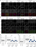 CENP-F-Nde1 controls corona stripping by dynein in untreated cells. (a) Immunofluorescence microscopy images of HeLa-K, CENP-F-Mut1, and CENP-F-Mut2 cells transfected with an empty vector, eGFP-CENP-F(2021–2901), or eGFP-CENP-F(2351–2901) and stained with DAPI and antibodies against CENP-E and CENP-C. Scale bar, 5 µm. (b) Immunofluorescence microscopy images of HeLa-K, CENP-F-Mut1, and CENP-F-Mut2 cells transfected with an empty vector, CENP-F^mEmerald, or CENP-FΔ1882–2292^mEmerald and stained with DAPI and antibodies against CENP-E and CENP-C. Scale bar, 5 µm. (c) Left: Quantification of kinetochore eGFP intensities minus background in cells expressing eGFP-CENP-F(2021–2901) or eGFP-CENP-F(2351–2901). Right: Quantification of kinetochore CENP-E intensities relative to CENP-C in HeLa-K, CENP-F-Mut1, and CENP-F-Mut2 cells transfected with an empty vector, eGFP-CENP-F(2021–2901), or eGFP-CENP-F(2351–2901). (d) Left: Quantification of kinetochore eGFP intensities minus background in cells expressing CENP-F^mEmerald or CENP-FΔ1882–2292^mEmerald. Right: Quantification of kinetochore CENP-E intensities relative to CENP-C in HeLa-K, CENP-F-Mut1, and CENP-F-Mut2 cells transfected with an empty vector, CENP-F^mEmerald, or CENP-FΔ1882–2292^mEmerald. In c and d, boxes depict the median and first and third quartiles, and whiskers represent Q1 and Q3 ± 1.5× interquartile range. ****, P < 0.0001.