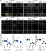 CENP-F-Nde1 controls corona stripping by dynein the nocodazole-monastrol assay. (a) Immunofluorescence microscopy images of the nocodazole-monastrol dynein-stripping assay in CENP-F-Mut1 and CENP-F-Mut2 cells transfected with an empty vector, eGFP-CENP-F(2021–2901), or eGFP-CENP-F(2351–2901) and stained with antibodies against CENP-E and CENP-C. Scale bar, 5 µm. (b) Immunofluorescence of the nocodazole-monastrol dynein-stripping assay in CENP-F-Mut1 and CENP-F-Mut2 cells transfected with an empty vector, CENP-F^mEmerald, or CENP-FΔ1882–2292^mEmerald and stained with antibodies against CENP-E and CENP-C. Scale bar, 5 µm. (c) Quantification of kinetochore CENP-E intensities relative to CENP-C in the nocodazole-monastrol assay depicted in a. (d) Quantification of kinetochore CENP-E intensities relative to CENP-C in the nocodazole-monastrol assay depicted in b. In c and d, boxes depict the median and first and third quartiles, and whiskers represent Q1 and Q3 ± 1.5× interquartile range. ****, P < 0.0001.