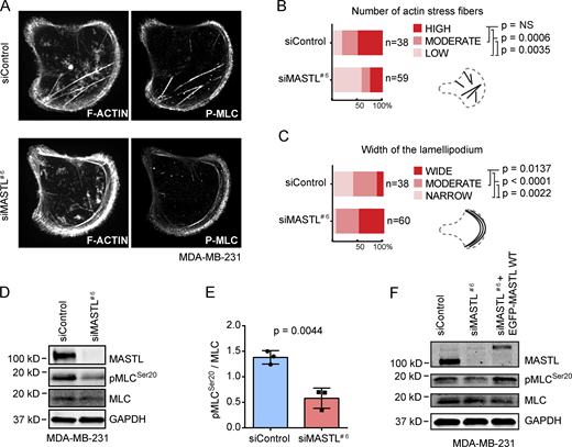 High MASTL levels promote contractile actin stress fibers. (A) Representative images of F-actin (Phalloidin-Atto) and pMLC (Thr18/Ser19) staining in siControl and siMASTL MDA-MB-231 cells plated on collagen-coated crossbow-shaped micropatterns (37 µm). (B) Quantification of the number of actin stress fibers in A (low, no obvious stress fibers; moderate, one to four stress fibers; high, five or more stress fibers). (C) Analysis of lamellipodium width from A, 38 (siControl) or 59 (siMASTL) cells in total. The width of the lamellipodium was measured from the widest point of the lamellipodium, 38 (siControl) or 60 (siMASTL) cells in total (narrow, 0–1.2 µm; moderate, 1.2–2 µm; and wide, >2 µm; n = 3 biologically independent experiments, Fisher’s exact test). (D) Western blot analysis of phosphorylated (Ser20) and total MLC (pMLC and MLC, respectively) and MASTL protein levels in siControl and siMASTL MDA-MB-231 cells. GAPDH was used as a loading control. (E) Quantification of pMLC relative to total MLC protein levels after MASTL silencing (n = 3 biologically independent experiments, unpaired t test, mean ± SD). (F) Western blot analysis of pMLC (Ser20) and total MLC, MASTL and GAPDH protein levels in siControl, siMASTL, and siMASTL + EGFP-MASTL (24 h MASTL silencing + 24 h expression of siRNA-resistant EGFP-MASTL) MDA-MB-231 cells. Shown is a representative blot of three biologically independent experiments with similar results. See also Table S1.
