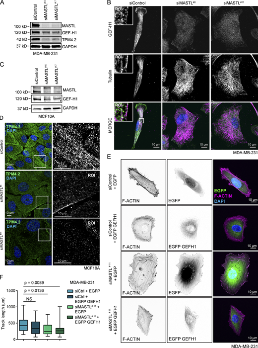 MASTL regulates GEF-H1, Tpm4.2, and NM-2B levels and GEFH1 rescues cell spreading, but not cell migration, in MASTL-silenced cells (related to Figure 5).(A) Western blot analysis of GEF-H1, Tpm4.2, and MASTL protein levels in siControl, siMASTL#6, and siMASTL#7 MDA-MB-231 cells. (B) Representative GEF-H1 and tubulin staining in siControl, siMASTL#6, and siMASTL#11 MDA-MB-231 cells. Images were acquired on a 3i CSU-W1 spinning disk confocal. (C) Western blot analysis of GEF-H1 and MASTL protein levels in siControl, siMASTL#6, and siMASTL#7 MCF10A cells. (D) Representative Tpm4.2 staining in siControl, siMASTL#6, and siMASTL#11 MCF10A cells. (E) Representative F-actin (Phalloidin-Atto) and DAPI staining in siControl and siMASTL#11 MDA-MB-231 cells transfected with EGFP or EGFP-GEF-H1 for 24 h and plated on collagen for 2 h. Images were acquired on a 3i CSU-W1 spinning disk confocal. (F) Migration track length of siControl and siMASTL#11 MDA-MB-231 cells transfected with EGFP or EGFP-GEF-H1 for 24 h. Cells were imaged every 10 min for 600 min in total (n = 3 biologically independent experiments, mean ± SD, unpaired t test). See also Table S1. Refer to the image caption for details.