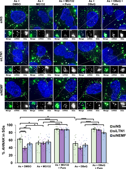 Treatment of cells depleted of LTN1 or NEMF with VCP or proteasome inhibitors does not further deplete AHNAK mRNAs from SGs during arsenite stress. U-2 OS cells expressing the SG marker G3BP1-GFP were depleted of LTN1 (siLTN1) or NEMF (siNEMF) using siRNAs or transfected with nonspecific control siRNAs (siNS). Cells were stressed with 0.5 mM arsenite (As) for 45 min with 0.1% DMSO (As + DMSO), 10 µM MG132 (As + MG132), 10 µM MG132 with 10 µg/ml puromycin (As + MG132 + Puro), 10 µM DBeQ (As + DBeQ), or 10 µM DBeQ with 10 µg/ml Puro (As + DBeQ + Puro), fixed, and smFISH for AHNAK mRNA was performed. Samples were imaged at 100× on a DeltaVision microscope. Representative image maximum intensity projections of 25 z-stacks are presented (top), with scale bars representing 10 µm (whole cells) or 2 µm (magnified panels), with G3BP1-GFP in green, AHNAK mRNAs in white, and nuclei in blue. The percent AHNAK mRNAs that colocalized with SGs was determined in individual cells, and the average ± SEM is shown (bottom) from two independent experiments. For siNS, As + DMSO n = 12 cells, As + MG132 n = 13 cells, As + MG132 + Puro n = 12 cells, As + DBeQ n = 12 cells, As + DBeQ + Puro n = 12 cells; for siLTN1, n = 12 cells for all conditions; for siNEMF, n = 12 cells for all conditions. Student’s t tests were done to assess significance, with *, P ≤ 0.05; **, P ≤ 0.01; and ****, P ≤ 0.001. Exact P values and source data are provided in Table S1.