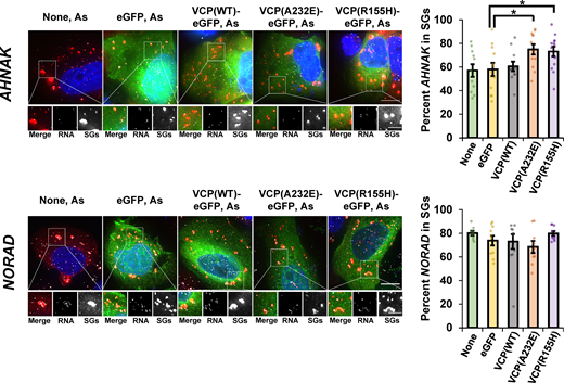 Pathogenic VCP alleles increase recruitment of AHNAK mRNAs, but not NORAD lncRNAs, to SGs. U-2 OS cells stably expressing the SG marker mRuby2-G3BP1 were either untransfected (None) or transiently transfected with empty vector peGFP-N1 (eGFP), WT VCP fused to eGFP (VCP(WT)-eGFP), or VCP alleles (VCP(A232E)-eGFP and VCP(R155H)-eGFP). Cells were stressed for 45 min with 0.5 mM arsenite (As) and then fixed, and smFISH was performed to detect AHNAK mRNA (top) or NORAD lncRNA (bottom). Representative photomicrographs for are shown at left, with RNAs shown in white, SGs in red, and eGFP in green. Images were acquired on a DeltaVision microscope at 100×, and maximum intensity projections of 25 z-stacks are shown. Scale bars, 10 µm (whole cell) or 5 µm (magnified panels). At right, average percent AHNAK mRNA or NORAD lncRNA ± SEM that colocalize with SGs. Three independent experiments were done with individual dots representing one frame, and only cells expressing eGFP were counted for all transfected conditions. For AHNAK, None n = 11 frames, GFP n = 12 frames, VCP(WT) n = 11 frames, VCP(A232E) n = 12 frames, VCP(R155H) n = 13 frames; for NORAD, None n = 8 frames, GFP n = 10 frames, VCP(WT) n = 10 frames, VCP(A232E) n = 9 frames, VCP(R155H) n = 9 frames. Student’s t test was done to assess significance between GFP and VCP(WT), VCP(A232E), or VCP(R155H) for AHNAK and NORAD, with *, P ≤ 0.05. Exact P values and source data are provided in Table S1. Refer to the image caption for details.