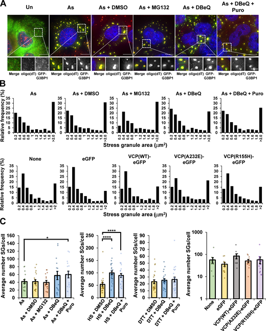 SGs contain polyadenylated mRNAs, and SG area and number are not substantially altered when VCP or the proteasome are inhibited, or when pathogenic VCP alleles are expressed during arsenite stress.(A) U-2 OS cells stably expressing the SG marker protein GFP-G3BP1 (green) were stressed for 45 min with 0.5 mM sodium arsenite (As) in the presence or absence of DMSO (0.1%), MG132 (10 µM), DBeQ (10 µM), or DBeQ (10 µM) and puromycin (Puro; 10 µg/ml), and then FISH was performed with oligo(dT)-Cy3 probes to detect polyadenylated transcripts (red). Nuclei are stained with DAPI (blue); these cells were also assessed for AHNAK mRNAs by smFISH (Fig. 2 A). Shown are representative maximum intensity projections of 25 z-stacks acquired at 100× on a DeltaVision microscope. Scale bars, 10 µm (whole cell) or 5 µm (magnified panels). Results represent n = two independent experiments. (B and C) Cells were treated as described in A, and the relative distribution of SG areas (B) and the number of SGs per cell (C) were determined using ImageJ/Fiji in the images used to quantify the fraction of AHNAK mRNAs (B) and both AHNAK and NORAD RNAs (C) colocalized with SGs (Fig. 2 and Fig. 3). For cells expressing VCP alleles (Fig. 7), results represent n = three independent experiments with average number of SGs per cell ± SEM shown in C. Student’s t test was done to assess significance, with *, P < 0.05 and ****, P < 0.001. Exact P values and source data are provided in Table S1.