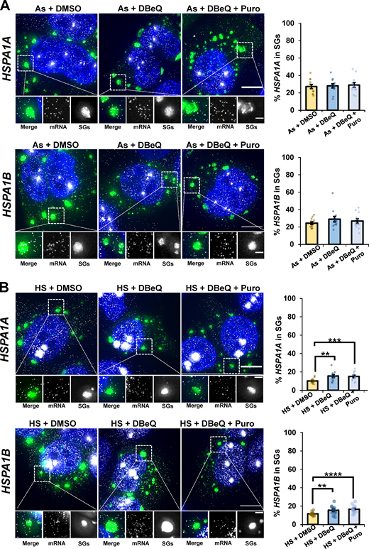 Stress-induced HSPA1A and HSPA1B mRNAs are not dependent on VCP to localize to SGs.(A and B) U-2 OS cells stably expressing the SG marker G3BP1-GFP were stressed for 45 min with arsenite (As; 0.5 mM; A) or heat stress (HS; 42°C; B) in the presence or absence of DMSO (0.1%), DBeQ (10 µM), or DBeQ (10 µM) plus puromycin (Puro; 10 µg/ml). Cells were fixed, and smFISH was performed to detect HSPA1A (top panels) and HSPA1B (bottom panels), and samples were imaged at 100× on a DeltaVision microscope. Representative maximum intensity projections of 25 z-stacks are shown at left with G3BP1-GFP in green, mRNAs in white, and nuclei in blue. Scale bars, 10 µm (whole cell) and 2 µm (magnified panels). The average ± SEM from two independent experiments is shown at right with individual data points shown for single cells (n = 12 cells for every condition). Student’s t test was performed to assess significance, with **, P < 0.01; ***, P < 0.005; and ****, P < 0.001. Exact P values and the source data are provided in Table S1.