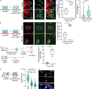 hNK cells induce apoptosis in K14+ invasive breast cancer cells.(A) Representative confocal images of the invading strands of tumor organoids (mTomato+) and caspase activity (green) cultured alone (top) or in coculture with hNK cells (bottom). Scale bar, 10 µm. (A′ and A″) Boxplot of the percentage of organoids with caspase activity in invading strands per biological replicate (A′) and the total number of invading strands with caspase activity (A″) cultured alone or in coculture with hNK cells. *, P < 0.05; ****, P < 0.0001 by Mann–Whitney U test. (B) Representative confocal images of tumor clusters organoids (mTomato+) and caspase activity (green) cultured alone (top) or in coculture with hNK cells (bottom). Scale bar, 10 µm. (B′) Boxplot of the percentage of tumor clusters per biological replicate with caspase activity in tumor clusters cultured alone or in coculture with hNK cells. *, P < 0.05 by Mann–Whitney U test. (C) Schema for assessing IFNγ activity in hNK cells in response to coculture with K14+ or K14− tumor cells. hNK cells were taken from ROSAmT/mG mice and in coculture with K14+ or K14− cells from K14-actin-GFP;MMTV-PyMT mice. In this experiment, hNK cells were fluorescently labeled with mTomato and K14+ cells were labeled with GFP. (C′) Boxplot of IFNγ expression among hNK cells after coculture with K14+ and K14− cells and normalized to K14− cells. Error bars represent 5th to 95th percentile. ***, P < 0.001 by Mann–Whitney U test. (D) Schema for assessment of the innate immune response to an initial metastatic seed. Tumor clusters from the mammary tumors of K14-actin-GFP;MMTV-PyMT;ROSAmT/mG mice were injected into the tail veins of immunocompetent mice, and the lung microenvironment was assessed after 6 h. (D′) Boxplot of the number of NK cells, macrophages, and neutrophils around a metastatic seed. Error bars represent 5th to 95th percentile. ***, P < 0.001; ****, P < 0.0001 by Kruskal–Wallis test. (D″) Representative slide scanned images of lung tissue field of view containing a K14+ (green), metastatic seed (magenta), surrounded by NK cells (NK1.1, white). Scale bar, 20 µm.
