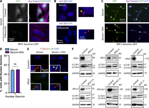 Confirmation of Palbociclib activity and depletion ofautophagy proteins by siRNA. (A) Immunofluorescence images of RPE1 Geminin:GFP cells treated with Palbociclib (200 nM) for 24 h to arrest the cell cycle. Geminin, the DNA replication inhibitor, is absent in G1 phase and is highly expressed at the beginning of S phase through G2. Using Palbociclib, cells were Geminin negative showing G0/G1 arrest. (B) Immunofluorescence images of RPE1 cells treated with Palbociclib (200 nM) for 24 h to arrest the cell cycle at G0/G1 phase. Arl13B was used as a ciliary marker. (C) Stitched images of RPE1 Geminin:GFP cells treated with or without Shh at LCD and stained for GFP, indicating cells expressing nuclear GFP signals. White arrows indicate the presence of Geminin in nucleus. (D) Quantification of cells expressing nuclear Geminin at different conditions as indicated. (E) RPE1 cells grown in serum, with or without Shh, after depletion of ATG5 as an example for autophagy genes siRNA screen. (F) Western blots probed for different autophagy proteins and LC3, indicating the efficiency of each KD and its effect on autophagy flux in RPE1 cells. Number of cells (n) used for each experiment (three repeats) is listed in Table S4. Yellow and red arrows indicate the presence or absence of a cilium, respectively.