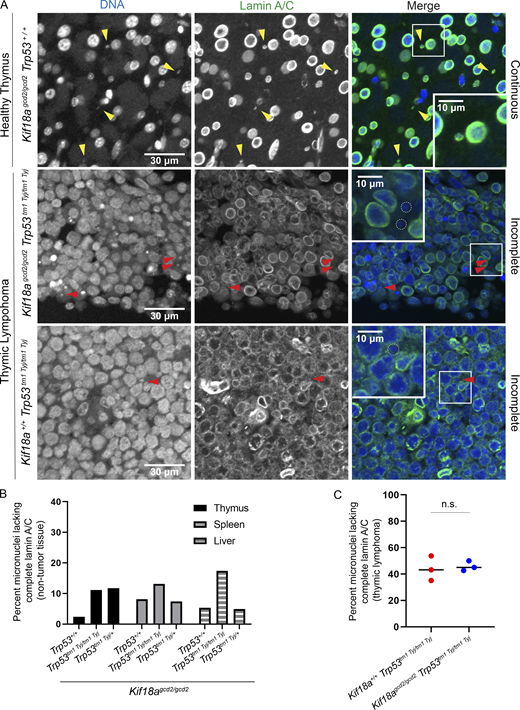 Micronuclear envelopes in Kif18a mutants are stable in healthy tissue but display incomplete lamin A/C recruitment in tumor cells.(A) Representative images of nuclear envelopes for primary nuclei and micronuclei occurring in healthy thymus tissue (top) and in thymic lymphoma (middle and bottom) from the indicated genotypes. Sections were stained with Hoechst (DNA, blue) and lamin A/C (green); yellow arrowheads indicate complete micronuclei through lamin A/C; red arrowheads show micronuclei with incomplete lamin A/C. (B) Plot showing the percentage of micronucleated cells experiencing micronuclear envelope disruption in healthy thymus, liver, and spleen tissues, as determined by incomplete lamin A/C signal co-occurring with micronuclear DNA. n = 3 tissue types per one biological replicate for each genotype (also see Table S1). (C) Plot showing percentage of micronuclei with nuclear envelopes lacking complete lamin A/C in thymic lymphoma tissues from the indicated genotypes. n = 3 biological replicates per genotype; P = 0.76, ns (also see Table S3). Data points indicate biological replicates, P values were calculated via unpaired Student’s t test.