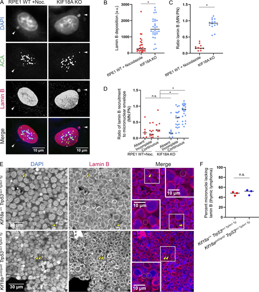 Micronuclei in KIF18A-deficient cells successfully recruit the noncore nuclear envelope component lamin B. (A) Representative images of fixed, micronucleated RPE1 cells labeled with DAPI (DNA, blue), ACA (centromeres, green), and lamin B (red). (B) Plot displaying lamin B fluorescence in micronuclear envelopes. Data are from three independent experiments. n = 27 (RPE1 + nocodazole washout), n = 28 (KIF18A KO). *, P < 0.001. Data points indicate individual micronuclei. (C) Plot displaying the ratio of lamin B fluorescence in the micronuclear envelope to lamin B recruited to the primary nuclear (PN) envelope of the same cell. Data are from three independent experiments. n = 10 (RPE1 + nocodazole washout), n = 14 (KIF18A KO). *, P < 0.0001. Data points indicate individual micronucleated cells. (D) Plot displaying the ratios of lamin B in the micronucleated envelope to lamin B in the PN envelope, parsed by continuous, incomplete, or absent lamin A/C recruitment, as assessed by costaining with lamin A/C antibody. n = 24 (RPE1 + nocodazole washout), n = 52 (KIF18A KO). *, P < 0.01. Data are from three independent experiments. Data points indicate individual micronucleated cells. (E) Representative images of thymic lymphoma tumor sections stained with Hoechst (DNA, blue) and lamin B (nuclear envelope, red); micronuclei indicated by yellow arrowheads. (F) Plot showing percentage of micronuclei in thymic lymphoma tissues that lacked lamin B. n = 3 biological replicates per genotype (also see Table S9). Data points indicate individual biological replicates. Indicated P values for numerical data were obtained using unpaired Student’s t test for comparisons between two conditions or a one-way ANOVA with Tukey’s post hoc test for comparisons among more than two conditions. Noc., nocodazole.