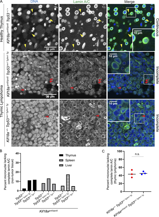 Micronuclear envelopes in Kif18a mutants are stable in healthy tissue but display incomplete lamin A/C recruitment in tumor cells.(A) Representative images of nuclear envelopes for primary nuclei and micronuclei occurring in healthy thymus tissue (top) and in thymic lymphoma (middle and bottom) from the indicated genotypes. Sections were stained with Hoechst (DNA, blue) and lamin A/C (green); yellow arrowheads indicate complete micronuclei through lamin A/C; red arrowheads show micronuclei with incomplete lamin A/C. (B) Plot showing the percentage of micronucleated cells experiencing micronuclear envelope disruption in healthy thymus, liver, and spleen tissues, as determined by incomplete lamin A/C signal co-occurring with micronuclear DNA. n = 3 tissue types per one biological replicate for each genotype (also see Table S1). (C) Plot showing percentage of micronuclei with nuclear envelopes lacking complete lamin A/C in thymic lymphoma tissues from the indicated genotypes. n = 3 biological replicates per genotype; P = 0.76, ns (also see Table S3). Data points indicate biological replicates, P values were calculated via unpaired Student’s t test. Refer to the image caption for details.