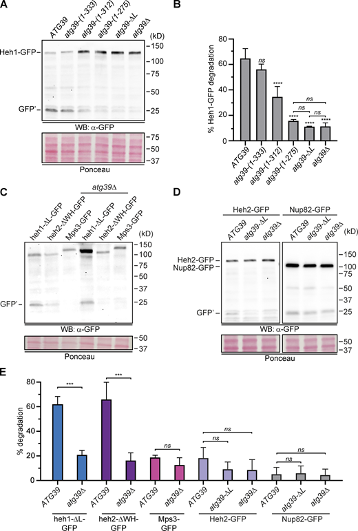 The autophagic degradation of Heh1-GFP requires the Atg39 lumenal domain.(A) Western blot (WB) of proteins from whole-cell extracts derived from cells expressing Heh1-GFP in strains with the indicated atg39 alleles cultured in medium lacking nitrogen (SD-N) for 24 h. GFP′ is a stable fragment of GFP in vacuoles. GFP detected with anti-GFP.1 antibody, HRP-conjugated secondary antibodies, and ECL. To assess relative protein loading, a portion of the blot is shown stained with Ponceau S. Position of mol wt standards (in kD) at right. (B) Plot of mean and error bars denoting SD of the percent degradation of Heh1-GFP from three independent experiments as in A. (C and D) WBs of proteins from whole-cell extracts derived from cells expressing the indicated GFP fusions in indicated strains cultured in SD-N medium for 24 h. GFP detected with anti-GFP.1 antibody, HRP-conjugated secondary antibodies, and ECL. To assess relative protein loading, a portion of the blots are shown stained with Ponceau S. Position of mol wt standards (in kD) at right. (E) Plot of mean and error bars denoting SD of the percent degradation of GFP-tagged proteins in the indicated strains from three independent experiments as in C and D. ***, P ≤ 0.001; ****, P ≤ 0.0001 by one-way ANOVA with Tukey’s correction. Source data are available for this figure: SourceData F5.