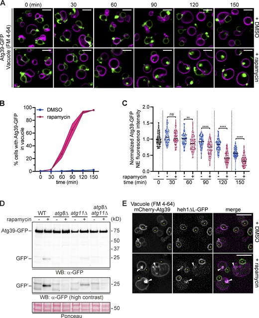 Atg39-containing NE blebs are delivered to vacuoles by autophagy.(A) Deconvolved fluorescence micrographs of a time course (30-min intervals) of rapamycin- or carrier-alone (DMSO)–treated cells expressing Atg39-GFP (green) in a pep4Δ strain; vacuoles are stained with FM 4-64 (magenta). Merged fluorescent images are shown. Image scale in green channel chosen to saturate the bleb fluorescence and allow visualization of NE. Scale bars are 3 μm. (B) Line plot of percentage of cells where Atg39-GFP is visible in vacuoles after treatment with rapamycin (circles and magenta line) or carrier (squares and blue line) over the time points indicated. 75 cells were evaluated each from three independent replicates. SD from the mean percentage is indicated by the shaded area. (C) Violin plot of the fluorescence intensity of Atg39-GFP along the nuclear periphery normalized to background fluorescence in the presence of rapamycin (+) or carrier (−) at the indicated time points. 30 cells each from three independent replicates were evaluated; each replicate was normalized to the mean NE fluorescence at 0 min. Solid line denotes the median; width of the violin plot denotes relative frequency of data points. **, P ≤ 0.01; ****, P ≤ 0.0001 by Brown–Forsythe and Welch ANOVA tests with Games–Howell test for multiple comparisons. (D) Western blot (WB) of proteins from whole-cell extracts derived from rapamycin- or carrier-alone (DMSO)–treated cells expressing Atg39-GFP in the indicated strains. GFP detected with anti-GFP.2 antibody, HRP-conjugated secondary antibodies, and ECL. To assess relative protein loading, a portion of the blots are shown stained with Ponceau S. Position of mol wt standards (in kD) at right. (E) Deconvolved fluorescence micrographs of rapamycin- or carrier-alone (DMSO)–treated cells overexpressing mCherry-Atg39 (magenta) and heh1-ΔL-GFP (green) in a pep4Δ strain; vacuoles are labeled with FM 4-64 (magenta). Merged fluorescent images shown. Asterisks denote the nucleus; arrowheads point to colocalization of GFP and mCherry in vacuole. Scale bars are 5 μm. Source data are available for this figure: SourceData F6.