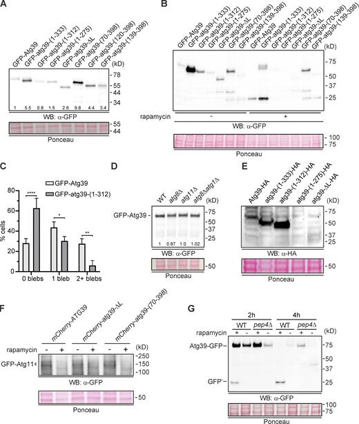 Assessment of total levels of Atg39 fusion proteins and Atg11 (supplemental to Figs. 2, 3, 5, and 6).(AandB) Western blot (WB) of proteins from whole-cell extracts derived from cells expressing the indicated GFP fusions in indicated strains and drug treatments. GFP detected with anti-GFP.1, HRP-conjugated secondary antibodies, and ECL. To assess relative protein loading, a portion of the blots are shown stained with Ponceau S. Position of mol wt standards (in kD) at right. In A, the numbers at the bottom of the blot correspond to the relative amount of each protein normalized to GFP-Atg39 using densitometry. (C) Plot of the percentage of cells with zero, one, or two or more NE blebs in GFP-Atg39 and GFP-atg39-(1–312) cells with similar levels of expression (as assessed by comparing total GFP fluorescence of individual cells). At least 100 cells from three independent replicates were evaluated, and mean and SD are plotted. *, P ≤ 0.05; **, P ≤ 0.01; ****, P ≤ 0.0001 by one-way ANOVA. (D) As in A and B. The numbers at the bottom of the blot correspond to the relative amount of each protein as assessed by densitometry normalized to GFP-Atg39. (E) WB of proteins from whole-cell extracts derived from cells expressing the indicated HA fusions expressed from endogenous ATG39 gene locus after 24 h in SD-N medium. HA detected with anti-HA antibody conjugated to HRP and ECL. To assess relative protein loading, a portion of the blots are shown stained with Ponceau S. Position of mol wt standards (in kD) at right. (F) WB of proteins from whole-cell extracts derived from cells expressing GFP-Atg11 alongside the indicated alleles encoding mCherry fusion proteins treated as indicated with rapamycin. GFP detected with anti-GFP.2, HRP-conjugated secondary antibodies, and ECL. To assess relative protein loading, a portion of the blots are shown stained with Ponceau S. Position of mol wt standards (in kD) at right. (G) As in A and B. Source data are available for this figure: SourceData FS2.