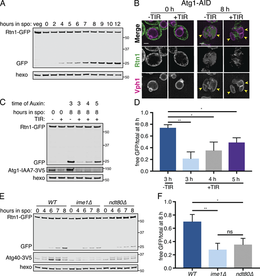 The ER is degraded by autophagy during meiosis.(A) Western blot with samples taken from cells expressing Rtn1-GFP during vegetative exponential growth (veg) or at the indicated time in meiosis probing for GFP and hexokinase (hexo) loading control. (B) Microscopy of cells expressing Rtn1-GFP, Vph1-mCherry, and Atg1-AID and imaged at the indicated times after transfer to SPO. Presence (+) or absence (−) of osTIR is indicated. Cells were treated with 500 µM auxin after 4 h in SPO. Yellow arrowheads indicate pockets of vacuole. (C) Western blot of cells of the same genotypes as in B probing for GFP, V5, and hexo. Cells were treated with 500 µM auxin at the indicated times. (D) Average and SD quantifying free GFP as a proportion of total GFP signal for n = 3 replicates of the experiment in C. P values calculated by Student’s t test. (E) Western blot with samples from cells of the indicated genotypes and expressing Rtn1-GFP and Atg40-3V5 taken at the indicated times after transfer to SPO, probed for GFP, V5, and hexo. (F) Average and SD quantifying free GFP as a proportion of total GFP signal for n = 3 replicates of the experiment in E. P values calculated by Student’s t test. ns, P > 0.05; *, P < 0.05; **, P < 0.01. Source data are available for this figure: SourceData F5.