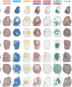 3D renderings of all β cells and organelles/organelle subtypes analyzed in this study. Color-coded are microtubule-associated and –not associated SGs, mitochondria, nuclei, microtubules, centrioles, centrosomal microtubules, Golgi apparati, and Golgi microtubules. Cubes on the right of each cell have a side length of 1 µm for scaling. assoc., associated; MT, microtubule; centr., centrosomal.