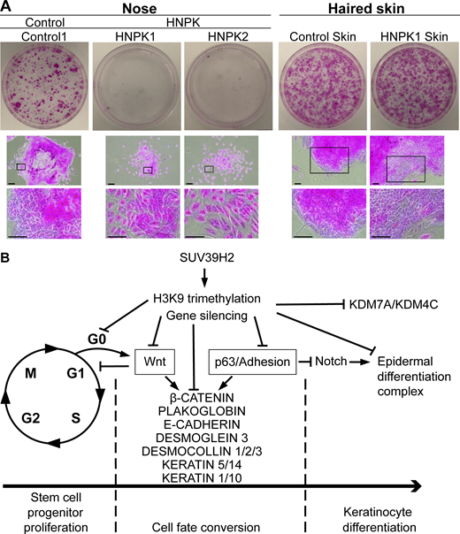 SUV39H2 loss of function reduces stem cell potential and proposed SUV39H2 epigenetic silencing scheme in nose keratinocytes.(A) Colony-forming efficiency (CFE) assay on control and HNPK nose and haired skin keratinocytes at passage 15 after 12 d in culture. Top panel: Overview of representative CFE plates stained with Rhodamine B. Bottom panel: Representative closeup pictures of CFE colonies. Note that HNPK nasal keratinocytes grow in a dispersed manner and fail to form colonies like control cells or HNPK skin keratinocytes. (n = 1 experiment on nasal keratinocytes from three different dogs and skin keratinocytes from two different dogs in triplicate). Scale bars, 25 µm. (B) Summary of the targeted signaling pathways epigenetically repressed by SUV39H2 in nasal epidermis revealed by ChIP-qPCR on representative genes (Fig. 5) and aligning with functional analyses of cultured nasal keratinocytes (Fig. 3, Fig. 6, and Fig. 8 A) and RNA-seq results from nasal planum biopsies (Fig. 2 and Table S1). Summary shows that SUV39H2 epigenetic gene silencing tampers fate conversion of proliferating progenitor cells toward epidermal differentiation through rate-limiting transcriptional repression of key effectors of the cell cycle (CDC25A, cyclin D1), the Wnt/p63/adhesion axis, and epidermal differentiation complex (see Discussion for complementary information). Progenitor-promoting Wnt signaling and downstream genes thereby represent core targets of SUV39H2 repression. If repression is relieved due to SUV39H2 inactivation, as shown in this study, H3K9me3 marks are erased, and overactivated Wnt signaling promotes the premature exit of progenitor cells from the cell cycle in concert with elevated expression of p63 and downstream targets, such as cell–cell adhesion components and keratin intermediate filaments. Consequences are exhaustion of stem and progenitor cells through enhanced mobilization while Notch signaling and terminal differentiation as well as genome stability are compromised. Results obtained in haired epidermis further suggest that SUV39H1 can compensate for loss of SUV39H2. Refer to the image caption for details.