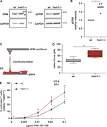 The hem1−/− DC–T cell priming defect is mediated by the pERM–ICAM1–LFA-1 axis.(A) Western blots for ERM, pERM, and GAPDH in mature WT and hem1−/− DCs, representative example of three biological replicates. (B) Relative intensity of pERM signal in mature WT and hem1−/− DCs, t test, three biological replicates. (C) Schematic overview of AFM setup for tether pulling. (D) Static tether force for mature WT and hem1−/− DCs, two biological replicates, t test. (E) Percentages of activated β2-integrin–deficient T cells assessed by CD62L/CD69 surface expression at indicated OVA323-339 peptide concentrations, three biological replicates, mean ± SD. Data were tested for normal distribution, transformed if necessary, and tested by using Student’s t test. ns, not significant. *, P ≤ 0.05; ***, P ≤ 0.001.