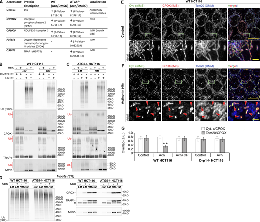 Identification of mitochondrial proteins ubiquitinated in cells with reduced MTF.(A) Summary of mass spectrometry analyzes of ubiquitinated proteins enriched in membrane fractions of Acn-treated versus control (DMSO-treated) cells. For the complete dataset, see Data S1. (B–D) Mitochondria-enriched HM and LM fractions from DMSO (control)– or Acn-treated WT (B) or ATG5−/− HCT116 (C) cells were subjected to Ub pull-down (PD) under denaturing conditions and analyzed by Western blot as indicated in the figure. Inputs (3% of samples used for the Ub pull-down) are shown in D. High-molecular-weight (apparently ubiquitinated) subsets of CPOX, TRAP1, and Mfn2 are marked with a red “Ub.” Upon stress, Mfn2 is degraded by the UPS (McLelland et al., 2018; Tanaka et al., 2010), and ubiquitination of this protein in Acn-treated cells was used as a reference. (E and F) WT HCT116 cells treated with DMSO (control; E) or Acn (F) were labeled to detect cytochrome c (Cyt. c; green), CPOX (red), and Tom20 (blue). Arrowheads in F indicate examples of high–cytochrome c/high-CPOX mitochondria. Detail images are from areas outlined with light green rectangles. Scale bars represent 20 µm (2 µm in detail images). (G) Overlap among cytochrome c, CPOX, and Tom20 in control and Acn-treated WT and Drp1−/− and Acn plus CP–treated WTHCT116 cells was estimated from maximum intensity projection images (exemplified in E and F). The values are shown as Pearson’s correlation coefficient. Data are represented as mean ± SD; n = 40 cells per condition. **, P < 0.01 versus control in WT HCT116 cells (all other samples were not significant); one-way ANOVA with Bonferroni correction (α = 0.05). Refer to the image caption for details.