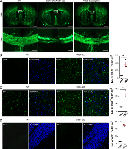 Loss of WDR91 leads to neuron degeneration.(A) Immunostaining of MBP in Wdr91f/f, Wdr91f/f Nestin cre and Wdr91f/f Olig2 cre mice at P21. Scale bars, 1,000 µm. Boxed regions in each image are magnified on the bottom to show the corpus callosum. Scale bars, 100 µm. (B–D) Immunostaining (left) and quantification (right) of GFAP (B) and Iba1 (C) in the cerebral cortex and AC3 in cerebellum (D) of WT and Wdr91 cKO mice at P21. Scale bars, 50 µm in B and C; 20 µm in D. For all quantifications, ≥3 mice in each genotype were analyzed. Error bars represent SEM. Data were from three independent experiments. **, P < 0.01; ***, P < 0.001.