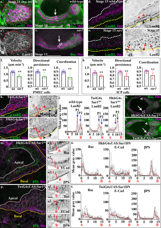 Secretion of laminins via the CopII pathway, from both the mesoderm and the midgut cells themselves, is required for their correct migration and MET. (a) Laminins (green) are strongly expressed in the posterior midgut cells in sna,twi mutant embryos. The posterior midgut is demarcated by dashed red lines. (b and c) In stage 13 sar1 zygotic mutants, the ICP cells (asterisks) are found more posteriorly than in wild-type (compare c with wild-type b; the same wild-type was used as in Fig. 2 d for comparison). (d) In the wild-type stage 15 midgut epithelium, two layers of laminin are found on the basal surface, one at the endoderm/mesoderm border (d′, red arrowheads) and the second on the outer surface of the mesoderm (d′, black arrowheads). Additionally, a lower level of LanB2 at the apical surface of midgut cells can be seen (d′, by white dotted line). (e) In stage 15 sar1 mutants, large intracellular punctae of laminins can be found (e, red arrows), indicating defects in laminin secretion (n = 40 embryos at stage 15; all embryos examined had multiple intracellular punctae of LanB2; representative image shown in e). (f and g) Velocity, directional persistence, and coordination values calculated from videos of wild-type (n = 11) and sar1 (n = 6) mutant embryos. n represents the average of a minimum of 15 cells in one embryo (shown as a dot). Data are presented as mean ± SEM. **, P ≤ 0.01 by unpaired two-tailed t test (see Table S1 for raw data). (h) TwiGal4 driving Sar1DN in the mesoderm leads to a loss of LanB2 staining at the endoderm/mesoderm interface (red arrowheads). Low levels of LanB2 staining can be seen throughout the mass of rounded midgut cells (black arrowheads point to the basal side of the visceral mesoderm). (i) HkbGal4 driving Sar1DN in the endoderm leads to a loss of LanB2 staining at the endoderm/mesoderm interface (red arrowheads), while LanB2 can still be seen on the opposite side of the mesoderm (black arrowheads). (j) Plots of the average fluorescence intensity (represented as mean gray value) of LanB2 in stage 15 midgut cells measured along the apical (A) to basal (B) axis of a cell (represented in b by red line). Each n represents the average of 10 cells measured in one embryo (black dotted lines). n = 6 per condition; the mean for each condition is plotted in red. In wild-type cells there is a peak of LanB2 at the endoderm mesoderm border (P1) and on the outer surface of the mesoderm (P2). In TwiG4xSar1DN, LanB2 levels are reduced, P1 appears as a broad diffuse peak, and P2 is either absent or greatly reduced (see Fig. S5 for FWMH). In HkbG4xSar1DN, the endoderm/mesoderm peak, P1, is either absent or greatly reduced, while more diffuse levels of LanB2 can still be seen on the opposite side of the visceral mesoderm (P2 FWMH increases from 1 µm in wild type to 1.8 µm; see Fig. S5). (k and l) Stage 13 embryos expressing Sar1DN in either the endoderm using HkbG4 (k) or mesoderm using TwiG4 (l). In both conditions, midgut migration is delayed; gaps are found between the anterior and posterior midgut rudiments (arrowheads) which have normally fused by stage 13; and the ICPs (asterisks) are found more posteriorly than in wild type (arrows). n = 40 embryos per condition; all embryos show gaps and/or mispositioned ICPs; representative images shown. (m–o) When the CopII pathway is blocked in midgut cells, they form a disorganized-looking monolayer of columnar or wedge-shaped cells, with βPS integrins localized to the apical and basal sides of the cells (n3), although quantification of levels reveals the peaks of βPS to be half that in wild type (o). In contrast, Baz (n1) and E-Cad (n2) are no longer restricted to the apical side of the cells (m–o) and are found in lower levels throughout the lateral membranes (m–o). (p–r) When Sar1DN is expressed in the mesoderm, midgut cells fail to form a monolayered epithelium, remaining rounded and multilayered (p), and Baz (q1) and E-Cad (q2) do not show any polarized localization within the midgut cells. βPS (q3) levels are very reduced, and basal βPS staining appears lost in midgut cells and diffuse throughout the underlying visceral mesoderm (p, q3, and broad basal peak in r). o and r show plots of the average fluorescence intensity (represented as mean gray value) of Baz, E-Cad, and βPS in stage 15 midgut cells measured along the apical (A) to basal (B) axis of a cell (represented in n and q by red line). Each n represents the average of 10 cells measured in one embryo (black dotted lines). n = 6 per condition; the mean for each condition is plotted in red. White dashed lines in d, e, h, i, m, and p indicate the apical side of the midgut, and yellow lines, the basal. Red boxes in m and p depict the area of the midgut epithelium shown in n and q. Confocal images are oriented with the anterior to the left and posterior to the right. Scale bars, 20 µm (a), 50 µm (b, c, k, and l), and 10 µm (d, e, h, i, m, n, p, and q).