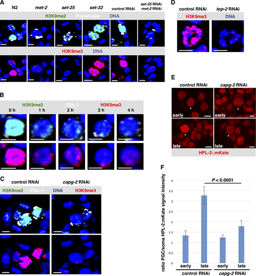 A TOP-2/condensin II–dependent increase in heterochromatin marks coincides with chromatin compaction in Z2/Z3.(A) Wild-type starved L1s and starved L1s that were defective for methyltransferases (mutants for met-2, set-25, set-32, and F1s from animals treated with met-2/set-25 double RNAi) were fixed and stained for P-granules (white), H3K9me2 (green), H3K9me3 (red), and DNA (blue). (n = 40). See Table S1 for a summary of signal intensities. (B) L1s were either starved or fed for a varying amount of time. Samples were then fixed and stained for P-granules (white), H3K9me3 (red), H3K9me2 (green), and DNA (blue). Representative images are shown. (n = 40). See Table S1 for a summary of signal intensities. (C) Starved L1s, born from strain N2 treated with either control RNAi or capg-2 RNAi, were fixed and stained for P-granules (white), H3K9me2 (green), H3K9me3 (red), and DNA (blue). Representative images are shown (n = 40). See Table S1 for a summary of signal intensities. (D) Starved L1s, born from strain N2 treated with either control or top-2 RNAi, were fixed and stained for H3K9me3 (red) and DNA (blue). Representative images are shown (n = 40). See Table S1 for a summary of signal intensities. (E) Worms that express HPL-2::mKate were optionally treated with control and capg-2 RNAi. Live embryos were extracted and were imaged for HPL-2 signal. The white star identifies Z2/Z3. Representative images are shown (n = 20). (F) Quantification of HPL-2::mKate signal from the images taken in E. Error bars represent one standard deviation. Scale bar represents a length of 2 µm.