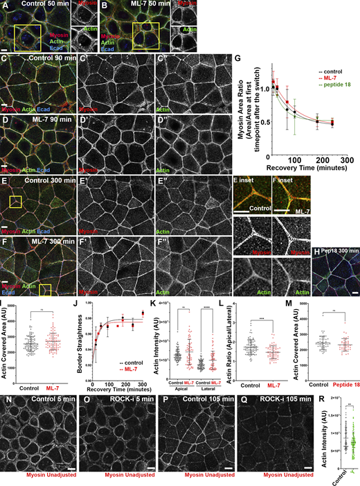 Inhibiting MLCK using ML-7 or peptide-18 does not alter myosin localization during recovery or prevent or delay assembly of the final ZA actomyosin structure.(A–F) Representative images showing cells in control vs. ML-7–treated cells at different time points during Ca recovery. By the last time point, cells assembled bundled F-actin decorated by sarcomeric myosin in both control and drug-treated conditions (E vs. F; H). (G and I–M) Quantification. Myosin maturation (G), actin bundling at the ZA (I and M), and border straightening (J) were similar in control and drug-treated conditions. After ML-7 treatment, there was some elevation of lateral actin and thus apical actin polarization was reduced (L). (N–Q) Representative images showing the difference in apical myosin signal in control (N and P) vs. ROCK-inhibited (O and Q) conditions. Myosin signal at the junction is reduced when ROCK is inhibited. (R) Quantification. Levels of apical actin were reduced after ROCK inhibition. In G, numbers for each time point are in Table S1. In I, K–M, and R, n = individual borders; control and ML7 = 94 (I); control = 80, ML7 = 63 (K and L); control = 45, peptide 18 = 43 (M); and control = 95, Y = 85 (R). In J, representative of five experiments with two fields of cells/experiment/time point, with seven to nine borders quantified/field. Statistical analysis was performed with unpaired two-way t tests (M) or one-way ANOVA tests and post hoc Tukey tests (I, K, L, and R). Error bars represent mean ± SD. ****, P < 0.0001; ***, P < 0.001; **, P < 0.01. Boxes indicate areas magnified at right.