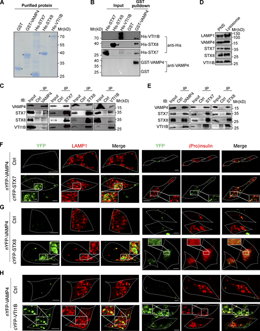 VAMP4 interacts with STX7, STX8, and VTI1B to form a SNARE complex on lysosomes. (A) GST and GST-tagged VAMP4 were purified by Glutathione Sepharose beads, and His-tagged STX7, STX8, and VTI1B were purified by Ni beads from E. coli. The purified proteins were determined by SDS–PAGE and Coomassie blue staining (n = 3 biological independent experiments). (B) Representative Western blot images showing the interaction of VAMP4 with STX7, STX8, and VTI1B determined by GST pulldown assay in vitro. His-tagged STX7, STX8, and VTI1B were immunoblotted (IB) with anti-His antibody, and GST and GST-tagged VAMP4 were immunoblotted with anti-VAMP4 antibody. GST protein was used as a negative control in the GST pulldown assay (n = 3 biological independent experiments). (C) The association of VAMP4, STX7, STX8, and VTI1B was detected by endogenous co-IP and immunoblotting with the indicated antibodies. IgG was used as a negative control in the co-IP assay. 3% of cell lysates and 10% of the immunoprecipitates were loaded (n = 4 biological independent experiments). (D) Representative Western blot images showing the expression levels of VAMP4, STX7, STX8, and VTI1B in the enriched lysosomal fraction. 15 μg of protein was loaded in each lane (n = 3 biological independent experiments). (E) The association of VAMP4, STX7, STX8, and VTI1B on lysosomes was detected by endogenous co-IP using enriched lysosomal fractions and immunoblotting with the indicated antibodies. IgG was used as a negative control in the co-IP assay. 3% of the isolated lysosomal fraction and 10% of the immunoprecipitates were loaded (n = 3 biological independent experiments). (F–H) INS-1 cells were transfected with nYFP-tagged VAMP4, cYFP-tagged STX7, and nYFP-tagged STX7 (F), cYFP-tagged STX8 and nYFP-tagged STX8 (G), cYFP-tagged VTI1B and nYFP-tagged VTI1B (H), and mCherry-tagged LAMP1 and mCherry-tagged (pro)insulin plasmids for 48 h under live-cell imaging. The interaction of nYFP-tagged VAMP4 with cYFP-tagged STX7, cYFP-tagged STX8, or cYFP-tagged VTI1B was detected by BiFC assay. The plasmids of nYFP-tagged STX7, nYFP-tagged STX8, and nYFP-tagged VTI1B were used as a negative control. mCherry-tagged LAMP1 (red) and mCherry-tagged (pro)insulin (red) represent lysosomes and iISGs, respectively. Scale bars, 5 μm (F–H) and 1 μm (insets in F–H). Source data are available for this figure: SourceData F6. Refer to the image caption for details.