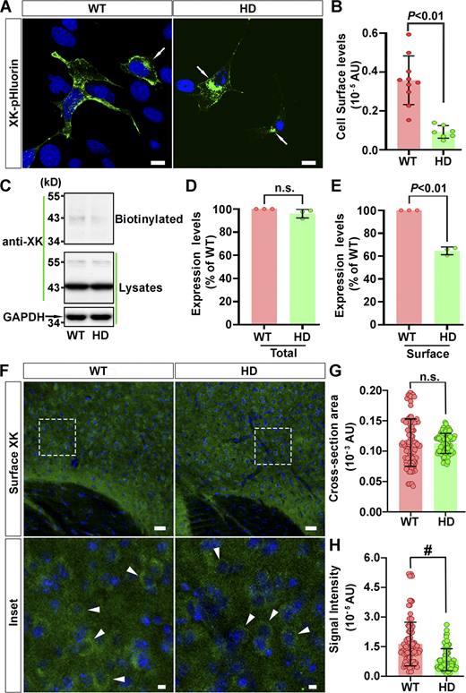 Defective trafficking of XK onto cell surfaces in HD cells. (A) Confocal images of SThdhQ7/Q7 and SThdhQ111/Q111 cells transiently transfected with plasmids expressing XK-pHluorin showed that pHluorin signals occurred at cell surfaces and intracellular compartments. Arrows point to cells with XK-pHluorin signals concentrated in the perinuclear regions. (B) Densitometry of pHluorin signals on the sharp edges of each of SThdhQ7/Q7 and SThdhQ111/Q111 cells showed a decline in the expression of XK-pHluorin on the surface of HD striatal cells. (C) Western blot analysis of biotinylated proteins and postnuclear supernatants of SThdhQ7/Q7 and SThdhQ111/Q111 cells with indicated antibodies. Shown are blot analyses from one of the three experiments. (D and E) Densitometry of signals of XK in postnuclear supernatants (total, D) and biotinylated XK (cell surfaces, E) for blot analyses in (C). (F) Images of XK staining in a brain section of WT and HD140Q/140Q mice. A series of consecutive coronal brain sections cut through the striatum were processed for labeling with antibodies for XK, with detergents omitted in all solutions to ensure the integrity of the plasma membrane. Images were captured from the nucleus accumubens of each brain section with the same settings. (G and H) Digital images from three brain sections for each of 3 WT and 3 HD mice were analyzed with the NIH ImageJ Fiji software to measure the cross-sectional area (G) and signal intensity (H) of striatal neurons immunoreactive to the XK antibody. Arrowheads in F indicate examples of neurons applied for densitometry and for measuring their cross-section areas. Scale bars: 20 μm (A), 100 μm (F), and 5 μm (inset in F). Data are mean ± SD. Each symbol in B, G, and H represents one cell and in D and E represents one experiment. Two-tailed Student’s t test. Source data are available for this figure: SourceData F4.