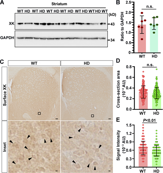 XK is expressed normally in the striatum but is diminished on the cell surface of striatal neurons in CAG140 knock-in mice. (A and B) Postnuclear striatal and cortical supernatants of WT (N = 7) and HD (N = 6) mice were analyzed by Western blot (A) followed by densitometry (B) to examine expression levels of XK. The age of the mice was 10 mo. (C–E) A series of three consecutive coronal brain sections cut through the striatum of WT and HD140Q/140Q mice were processed for labeling with antibodies for XK with the same procedures as in Fig. 4. Immunolabeled XK molecules were detected by the avidin–biotin peroxidase method. (C) Images of immunolabeled XK in one brain section of one animal for WT and HD. Boxed regions were enlarged and shown below the corresponding photograph. (D and E) Digital images captured from the striatum of four brain sections for each genotype were analyzed with the NIH ImageJ/Fiji software to measure the cross-sectional areas (D) and signal intensity (E) of striatal neurons immunoreactive to the XK antibody. Scale bars: 150 μm. Intensities of XK, as well as GAPDH (A), immunoreactive signals were measured with the NIH ImageJ/Fiji software. Data are mean ± SD. Each symbol represents one animal (A) and one cell (D and E), respectively. Two-tailed Student’s t test was done for comparison. Source data are available for this figure: SourceData FS3. Refer to the image caption for details.