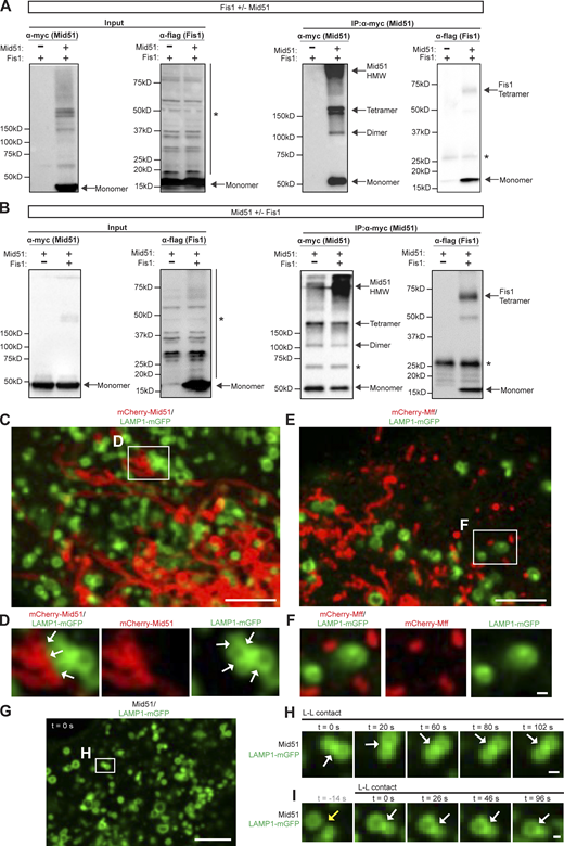 Mid51 interacts with Fis1 in a Mid51/Fis1 complex and regulates mitochondrial and lysosomal tethering. (A) IP of myc-tagged WT Mid51 and co-IP of Flag-tagged WT Fis1, with corresponding input, with and without Mid51, confirming that IP of Mid51 and co-IP of Fis1 is dependent on the presence of Mid51 (lane 2). See Fig. 4, A and B, for quantification. *, Nonspecific bands. (B) IP of myc-tagged WT Mid51 and co-IP of Flag-tagged WT Fis1, with corresponding input, with and without Fis1, confirming that co-IP of Fis1 is dependent on the presence of Fis1 (lane 2). See Fig. 4, C and D, for quantification. *, Nonspecific bands. (C and D) Confocal time-lapse microscopy showing lysosomal cluster of inter-lysosomal tethers which are also tethered to mitochondria (white arrows, inset in D) in live HeLa cells expressing Mid51 (mitochondria mCherry-Mid51; lysosome LAMP1-mGFP). Scale bars, 5 μm (C); 0.5 μm (D). (E and F) Confocal time-lapse microscopy showing few inter-lysosomal tethers or mitochondria–lysosome tethers (inset in F) in live HeLa cells expressing Mff (mitochondria mCherry-Mff; lysosome LAMP1-mGFP). Scale bars, 5 μm (E); 0.5 μm (F). (G–I), Confocal time-lapse microscopy showing prolonged inter-lysosomal (L-L) tethering (white arrows; inset in H; I) in live HeLa cells expressing Mid51 (lysosome LAMP1-mGFP). Scale bars, 5 μm (G); 0.5 μm (H and I). Video 8 corresponds to H. Source data are available for this figure: SourceData FS3.