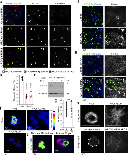 MRCKβ is required for cup morphogenesis and particle internalization. (a–c) Confocal xy scanning analysis of Dbl3-depleted cells using two distinct MRCKβ siRNAs in primary porcine RPE cultures treated with POS-FITC for 1 h followed by 2-h chase. Cells were fixed and not permeabilized to detect external bound POS using anti–Annexin 5 antibody in addition to total POS-FITC. (d) siRNA-mediated knockdown of MRCKβ in primary porcine RPE cells leads to prolonged, longer, and disordered pseudopods with increased F-actin labeling. (e) Inhibition of MRCKβ kinase activity using BDP5290 results in a membrane remodeling defect in a similar manner to knock-down of MRCKβ. Note, POS is often misaligned and not centered at extended pseudopods in either MRCKβ siRNA-treated or BDP5290-treated cells, as indicated by green arrowheads in the confocal xy-scanning sections. (f) N-WASP and MRCK inhibitors in cells treated with POS for 30-min block clustering of mechanosensory talin. (g–i) Confocal xy analysis of integrin αvβ5 distribution in cups with or without MRCKβ inhibition or knockdown. Note, inhibition of MRCKβ-driven actomyosin contractility results in loss of integrin αvβ5 clustering along the deformed pseudopods that do not mature into normal cylindrical cups, as highlighted by F-actin staining. (j) pMLC and F-actin labeling increase during transition from nascent protrusion to cup formation. Scale bars represent 10 μm. All quantifications are based on n = 3 independent experiments and show the data points, means ±1SD, the total number of cells analyzed for each type of sample across all experiments, and P values derived from t tests. Source data are available for this figure: SourceData FS3. Refer to the image caption for details.