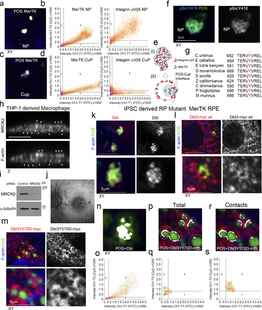 MerTK-signaling during phagocytosis. (a–e) Primary porcine RPE cells were analyzed by confocal xy scanning microscopy for localization of the receptor relative to POS using colocalization software based on the Pearson’s correlation coefficient. Grid 3 of the scatter charts contains the colocalization data calculations. Colocalization of POS-FITC with MerTK is depicted in white. Note, colocalization of MerTK with membrane-bound POS is nearly total at nascent protrusions (NP). MerTK also localizes at cups and contact sites but more substantially with total POS. Colored outlines of nascent protrusions, cups, or POS-cup contacts represent areas used for calculating of colocalization coefficients. (f) Confocal microscopy analysis of primary RPE treated with POS-FITC revealed activated MerTK receptor-associated tyrosine kinase Src (pSrcY416) at nascent protrusions. (g) Sequence alignment of the Dbl GEF motif for activation by c-Src tyrosine phosphorylation in diverse mammalian species demonstrating high evolutionary conservation. (h) Confocal z-sectional analysis of THP-1–derived macrophages reveal MRCKβ localizes along the actin cortex. White arrowheads highlight apical- and basal-facing sections of the F-actin cortex. (i) Immunoblot demonstrating siRNA knockdown of MRCKβ in THP-1–derived macrophages. (j) Autofluorescence image of a magnified area of the posterior pole. The speckled darker area at the central macula represents a dropout of RPE cells from an individual carrying a loss of function MerTK mutation that causes retinitis pigmentosa (RP) and vision loss. (k) confocal xy scanning fluorescence image of RPE cells differentiated from iPSCs derived from an RP individual reveals an accumulation of adhesion sites with enriched Dbl at POS contact sites but no wrapping of POS. (l and m) Expression of Dbl3Y570D-myc tyrosine phospho-mimetic mutant promotes efficient nascent adhesion maturation despite loss of upstream MerTK function. (n–s) RP individual iPSC-derived RPE expressing different forms of Dbl analyzed by confocal xy scanning microscopy using colocalization software based on the Pearson’s correlation coefficient. Note, colored outlines in the confocal xy-section images represent areas of calculation. Dbl3Y570D fully restores progression from almost complete colocalization at adhesion sites to POS-membrane Dbl3 interface contacts. Note, Grid 3 of the scatter graph represents colocalization data calculations and Dbl colocalization with POS is highlighted in white. All quantifications are based on n = 3 independent experiments. Source data are available for this figure: SourceData FS5.
