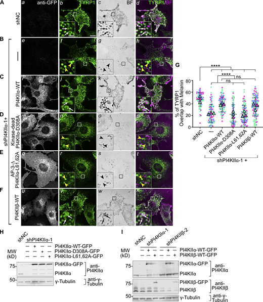 PI4KIIα function in TYRP1 trafficking requires its lipid kinase activity and binding to adaptor AP-3. (A–F) Melan-Ink4a melanocytes were untransduced (A and B) or transduced with retroviruses to express GFP-tagged human PI4KIIα-WT (C), kinase-dead mutant PI4KIIα-D308A (D), AP-3-binding-deficient mutant PI4KIIα-L61,62A (E), or PI4KIIβ-WT (F), selected with hygromycin for at least 2 wk, and then transduced with lentiviruses to express shNC or shPI4KIIα-1. (A–F) 7–9 d later, cells were analyzed by IFM for GFP (white; left panels) and TYRP1 (green; middle left and right panels) and by bright field microscopy for pigment granules (BF; middle right panels; pseudocolored magenta at right). White arrows, TYRP1 surrounding pigment granules; yellow arrowheads, TYRP1 not overlapping with pigment granules. Boxed regions are magnified fivefold in the insets. Scale bars: main panels, 10 μm; insets, 2 μm. (G) Quantification of TYRP1 overlap with melanosomes from at least three independent experiments, with analyses by Welch’s ANOVA; ****, P < 0.0001. (H and I) Whole-cell lysates from cells in A–E (H) or F and Fig. 4 F (I) were analyzed by SDS/PAGE and immunoblotting for PI4KIIα (H) or both PI4KIIα and PI4KIIβ (I) and γ-Tubulin as a loading control. Left, positions of molecular weight markers (MW). Source data are available for this figure: SourceData F3.