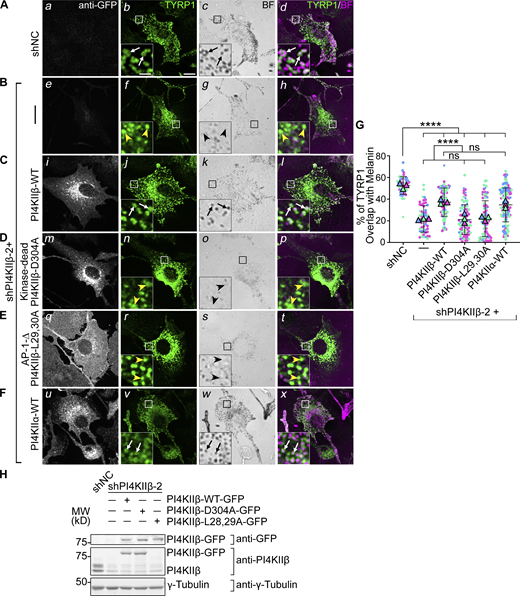 PI4KIIβ function in TYRP1 trafficking requires its lipid kinase activity and binding to adaptor AP-1. (A–F) Melan-Ink4a cells were untransduced (A and B) or transduced with retroviruses to express GFP-tagged human PI4KIIβ-WT (C), kinase-dead mutant PI4KIIβ-D304A (D), AP-1-binding-deficient mutant PI4KIIβ-L29,30A (E) or PI4KIIα-WT (F), selected for at least 2 wk, and then transduced with lentiviruses expressing shNC or shPI4KIIβ-2 shRNA to PI4KIIβ. (A–F) 7–9 d after shRNA transduction, cells were analyzed by IFM for GFP (white; left panels) and TYRP1 (green; middle left and right panels) and by bright field microscopy for pigment granules (BF; middle right panels and pseudocolored magenta at right). White arrows, TYRP1 surrounding pigment granules; yellow arrowheads, TYRP1 not overlapping with pigment granules. Boxed regions are magnified fivefold in the insets. Scale bars: main panels, 10 μm; insets, 2 μm. (G) Quantification of TYRP1 overlap with pigment granules from at least three independent experiments and analysis by Welch’s ANOVA; ****, P < 0.0001. (H) Whole-cell lysates from cells in A–E were analyzed by SDS/PAGE and immunoblotting for GFP, PI4KIIβ and γ-Tubulin as a loading control (note, the L28, 29A mutant is not recognized by the anti-PI4KIIβ antibody). Left, positions of molecular weight markers (MW). Immunoblotting for PI4KIIα in cells (F) is shown in Fig. 3. Source data are available for this figure: SourceData F4.