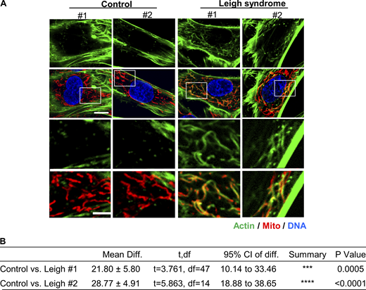 Actin assembly in Leigh syndrome fibroblasts. (A) Micrographs of actin staining (TRITC-phalloidin, green) around mitochondria (Tom20, red) for control and Leigh syndrome fibroblasts. Scale bars are 10 µm (full cell) and 5 µm (inset). (B) Table giving P values for comparisons of graph in Fig. 4 I using unpaired Student’s t test. Ctrl #1–2 were combined for analysis. Number of experiments and sample sizes are provided in Table S1.