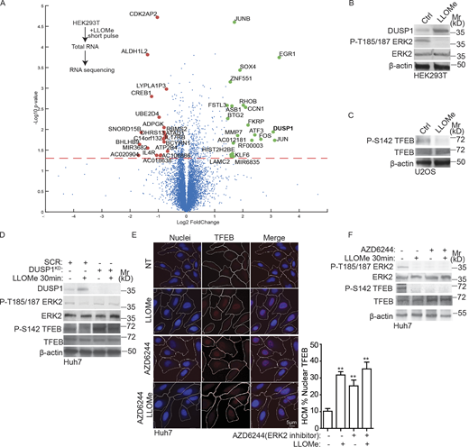 Cellular transcriptional response during lysosomal damage. (A) RNAseq analysis of the change in gene expression (HEK293T cells) in response to treatment with 1 mM LLOMe for 30 min. Scatter (volcano) plot shows log2 fold change and −Log10 P value for the genes identified in three independent experiments (see Table S1, Tab 3). Red dots indicate the genes downregulated; green dots indicate the genes upregulated. Dashed line, significance cut-off (P < 0.05). (B) Immunoblot analysis of DUSP1 expression level and ERK2 (T185/187) phosphorylation in HEK293T cells treated with 1 mM LLOMe for 30 min. (C) Immunoblot analysis of TFEB (S142) phosphorylation in U2OS cells treated with 2 mM LLOMe for 30 min. (D) Immunoblot analysis of ERK2 (T185/187) and TFEB (S142) phosphorylation in Huh7 cells transfected with scrambled siRNA as control (SCR) or DUSP1 siRNA treated with 2 mM LLOMe for 30 min. (E) Quantification by HCM of TFEB nuclear translocation in Huh7 cells treated with or without 530 nM ERK2 inhibitor AZD6244 for 2 h followed by 2 mM LLOMe for 30 min. Blue: nuclei, Hoechst 33342. Red: anti-TFEB antibody, Alexa Fluor 568. White masks, computer-algorithm-defined cell boundaries. Pink masks, computer-identified nuclear TFEB based on the average intensity of Alexa Fluor 568 fluorescence. (F) Immunoblot analysis of ERK2 (T185/187) and TFEB (S142) phosphorylation in Huh7 cells treated with or without 530 nM ERK2 inhibitor AZD6244 for 2 h followed by 2 mM LLOMe for 30 min. Ctrl, control (untreated cells). Data, means ± SEM; HCM: n ≥ 3 (each experiment: 500 valid primary objects/cells per well, ≥5 wells/sample). **, P < 0.01, ANOVA. Source data are available for this figure: SourceData F2. Refer to the image caption for details.