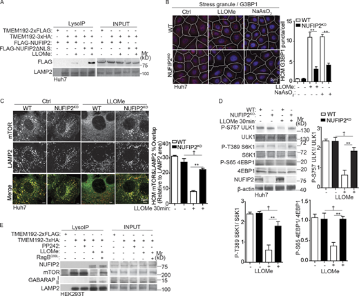 NUFIP2 contributes to mTOR inactivation during lysosomal damage. (A) Immunoblot analysis of FLAG-NUFIP2 or FLAG-NUFIP2ΔNLS associated with purified lysosomes (LysoIP; TMEM192-3xHA). Huh7 cells transfected with FLAG-NUFIP2 or FLAG-NUFIP2ΔNLS, treated or not with 2 mM LLOMe for 30 min. TMEM192-2xFLAG, control. (B) Quantification by HCM of G3BP1 puncta in parental Huh7 (WT) and NUFIP2-knockout Huh7 cells (NUFIP2KO) treated with 2 mM LLOMe or 100 µM NaAsO2 for 30 min. Red masks, computer-identified G3BP1 puncta. (C) Quantification by HCM of overlaps and confocal microscopy imaging of mTOR and LAMP2 in parental Huh7 (WT) and NUFIP2-knockout Huh7 cells (NUFIP2KO) treated with 2 mM LLOMe for 30 min. HCM images in Fig. S3 H. Scale bar, 5 µm. (D) Immunoblot analysis of indicated proteins in parental Huh7 (WT) and NUFIP2-knockout Huh7 cells (NUFIP2KO) treated with 2 mM LLOMe for 30 min. The level of phosphorylation of ULK1 (S757), S6K (T389), and 4EBP1 (S65) was quantified based on three independent experiments. (E) Immunoblot analysis of proteins associated with purified lysosomes (LysoIP) from HEK293T cells treated with 1 μM PP242 for 2 h or 2 mM LLOMe for 30 min or HEK293T cells stably expressing constitutively active RagB GTPase (RagBQ99L) treated with 2 mM LLOMe for 30 min. Ctrl, control (untreated cells). Data, means ± SEM; HCM: n ≥ 3 (each experiment: 500 valid primary objects/cells per well, ≥5 wells/sample). †, P ≥ 0.05 (not significant); **, P < 0.01, ANOVA. See also Fig. S3. Source data are available for this figure: SourceData F4. Refer to the image caption for details.