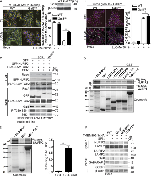 NUFIP2 and Gal8 cooperate in mTOR response to lysosomal damage. (A) Quantification by HCM of overlaps between mTOR and LAMP2 in Gal8WTHeLa (WT) or Gal8KOHeLa (Gal8KO) cells treated with 2 mM LLOMe for 30 min. Yellow masks, computer-identified overlap of mTOR and LAMP2. (B) Quantification by HCM of G3BP1 puncta in Gal8WTHeLa (WT) or Gal8KOHeLa (Gal8KO) cells treated with 2 mM LLOMe for 30 min. Red masks, computer-identified G3BP1 puncta. (C) HEK293T cells stably expressing FLAG-LAMTOR2 with overexpression of GFP or GFP-NUFIP2 were transfected with scrambled siRNA as control (SCR) or Gal8 siRNA (Gal8KD). Cells were treated with 200 µM GPN for 30 min. Cell lysates were immunoprecipitated with anti-FLAG antibody and immunoblotted for indicated proteins. (D) GST pulldown assay of in vitro translated and radiolabeled Myc-tagged NUFIP2 or G3BP1 with GST or GST-tagged Ragulator or Gal8. (E) GST pull-down assay of in vitro translated and radiolabeled Myc-tagged NUFIP2 with GST or GST-tagged Gal8. Quantification, n = 3. (F) Analysis of indicated proteins associated with lysosomes purified by anti-HA immunoprecipitation (LysoIP; TMEM192-3xHA) from HeLa WT, Gal8KO, GABARAPs knockout (GBRPTKO) or G3BP1 knockdown (G3BP1KD) cells. Cells were treated with 200 µM GPN for 30 min. AR, autoradiography. Ctrl, control (untreated cells). Data, means ± SEM; HCM: n ≥ 3 (each experiment: 500 valid primary objects/cells per well, ≥5 wells/sample). †, P ≥ 0.05 (not significant); **, P < 0.01, ANOVA. See also Fig. S3. Source data are available for this figure: SourceData F6.