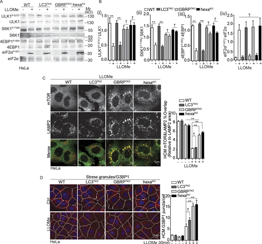 GABARAPs participate in mTOR inactivation but not in eIF2α phosphorylation in response to lysosomal damage. (A) Immunoblot analysis of the phosphorylation ULK1 (S757), S6K (T389), 4EBP1 (S65), and eIF2α (S51) in parental HeLa (WT), LC3TKO, GBRPTKO, and hexaKO cells treated with 4 mM LLOMe for 30 min. (B ⅰ–ⅳ) Quantification of phosphorylation of ULK1 (S757; i), S6K (T389; ii), 4EBP1 (S65; iii), and eIF2α (S51; iv) in A; Quantification, n = 3. (C) Quantification by HCM and confocal microscopy analysis of overlaps between mTOR and LAMP2 in parental HeLa (WT), LC3TKO, GBRPTKO, and hexaKO cells treated with 4 mM LLOMe for 30 min. HCM images in Fig. S4 M. Scale bar, 5 µm. (D) Quantification by HCM of G3BP1 puncta. Parental HeLa (WT), LC3TKO, GBRPTKO, and hexaKO cells were treated with 4 mM LLOMe for 30 min. Red masks, computer-identified G3BP1 puncta. Data, means ± SEM; HCM: n ≥ 3 (each experiment: 500 valid primary objects/cells per well, ≥5 wells/sample). †, P ≥ 0.05 (not significant); **, P < 0.01, ANOVA. See also Fig. S4. Source data are available for this figure: SourceData F8. Refer to the image caption for details.