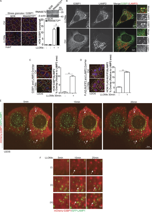 SGs induced by lysosomal damage show limited and dynamic interactions with lysosomes. (A) Quantification by HCM of G3BP1 puncta in Huh7 cells transfected with scrambled siRNA as control (SCR) or RNASET2 siRNA treated with 2 mM LLOMe for 30 min. Red masks, computer-identified G3BP1 puncta. (B) Immunofluorescence confocal microscopy analysis of G3BP1 and LAMP2. U2OS cells were treated with 2 mM LLOMe for 30 min and stained for endogenous G3BP1 and LAMP2. Scale bar, 5 µm. (C) Quantification by HCM of overlaps between G3BP1 and LAMP2 in U2OS cells treated with 2 mM LLOMe for 30 min. White masks, algorithm-defined cell boundaries. Yellow masks, computer-identified overlap of G3BP1 and LAMP2. (D) Quantification by HCM of overlaps between FLAG-NUFIP2 and LAMP2 in U2OS cells expressing FLAG-NUFIP2 treated with 2 mM LLOMe for 30 min. Yellow masks, computer-identified overlap of FLAG-NUFIP2 and LAMP2. (E) Still frames from live-cell fluorescence imaging analysis of mCherry-G3BP1 and GFP-LAMP1. U2OS cells expressing mCherry-G3BP1 and GFP-LAMP1 were incubated with 2 mM LLOMe during live-cell fluorescence imaging. Arrows, the representative regions at indicated timepoint. (F) Zoom views of regions in E. Ctrl, control (untreated cells). Data, means ± SEM; HCM: n ≥ 3 (each experiment: 500 valid primary objects/cells per well, ≥5 wells/sample). †, P ≥ 0.05 (not significant); **, P < 0.01, ANOVA. Source data are available for this figure: SourceData FS2.