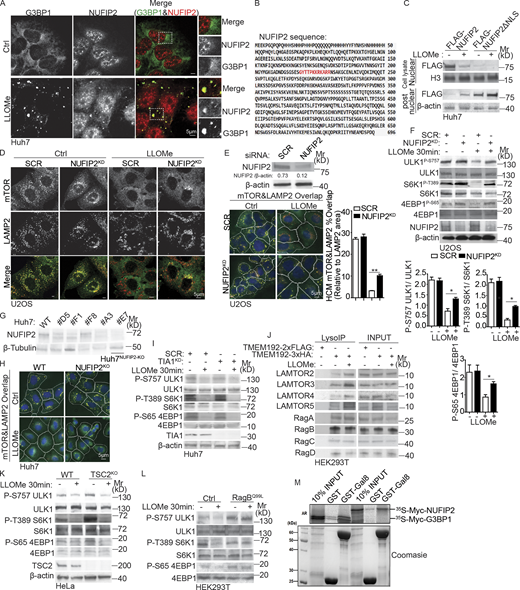 NUFIP2 exits nucleus and localizes to lysosomes upon damage and cooperates with Gal8 in mTORC1 response to lysosomal damage. (A) Immunofluorescence confocal microscopy analysis of G3BP1 and NUFIP2. Huh7 cells were treated with 2 mM LLOMe for 30 min and stained for endogenous G3BP1 and NUFIP2. Scale bar, 5 µm. (B) The NLS analysis of NUFIP2 by cNLS Mapper. The sequence in red, predicted NLS in NUFIP2, was deleted for generating NUFIP2ΔNLS. (C) Immunoblot analysis of NUFIP2 distribution in nuclear or postnuclear of Huh7 cells transfected with FLAG-NUFIP2 or NUFIP2ΔNLS after the treatment with 2 mM LLOMe for 30 min. (D and E) Confocal microscopy analysis (D) and quantification by HCM (E) of overlaps between mTOR and LAMP2 in U2OS transfected with scrambled siRNA as control (SCR) or NUFIP2 siRNA (NUFIP2KD) treated with 2 mM LLOMe for 30 min. Scale bar, 5 µm. (F) Immunoblot analysis of indicated proteins in U2OS cells transfected with scrambled siRNA as control (SCR) or NUFIP2 siRNA (NUFIP2KD) treated with 2 mM LLOMe for 30 min. The level of phosphorylation of ULK1 (S757), S6K (T389), and 4EBP1 (S65) was quantified based on three independent experiments. (G) Immunoblot validation of NUFIP2-knockout in Huh7 cells. #E7 was used in the following experiments, named as Huh7NUFIP2-KO. (H) HCM images of Fig. 4C. Yellow masks, computer-identified overlap of mTOR and LAMP2. (I) Immunoblot analysis of indicated proteins in Huh7 cells transfected with scrambled siRNA as control (SCR) or TIA1 siRNA (TIA1KD) treated with 2 mM LLOMe for 30 min. (J) Analysis of indicated proteins associated with lysosomes purified by anti-HA immunoprecipitation (LysoIP; TMEM192-3xHA) from HEK293T cells treated with 2 mM LLOMe for 30 min. TMEM192-2xFLAG, control. (K) Immunoblot analysis of the phosphorylation of ULK1 (S757), S6K1 (T389) and 4EBP1 (S65) in parental HeLa (WT) and TSC2-knockout HeLa cells (TSC2KO) treated with 2 mM LLOMe for 30 min. (L) Immunoblot analysis of the phosphorylation of ULK1 (S757), S6K1 (T389), and 4EBP1 (S65) in HEK293T cells or HEK293T cells stably expressing constitutively active RagB GTPase (RagBQ99L) treated with 2 mM LLOMe for 30 min. (M) GST pull-down assay of in vitro translated and radiolabeled Myc-tagged NUFIP2 or G3BP1 with GST or GST-tagged Gal8. AR, autoradiography. Ctrl, control (untreated cells). Data, means ± SEM; HCM: n ≥ 3 (each experiment: 500 valid primary objects/cells per well, ≥5 wells/sample). *, P < 0.05; **, P < 0.01, ANOVA. See also Figs. 4, 5, and 6. Source data are available for this figure: SourceData FS3. Refer to the image caption for details.